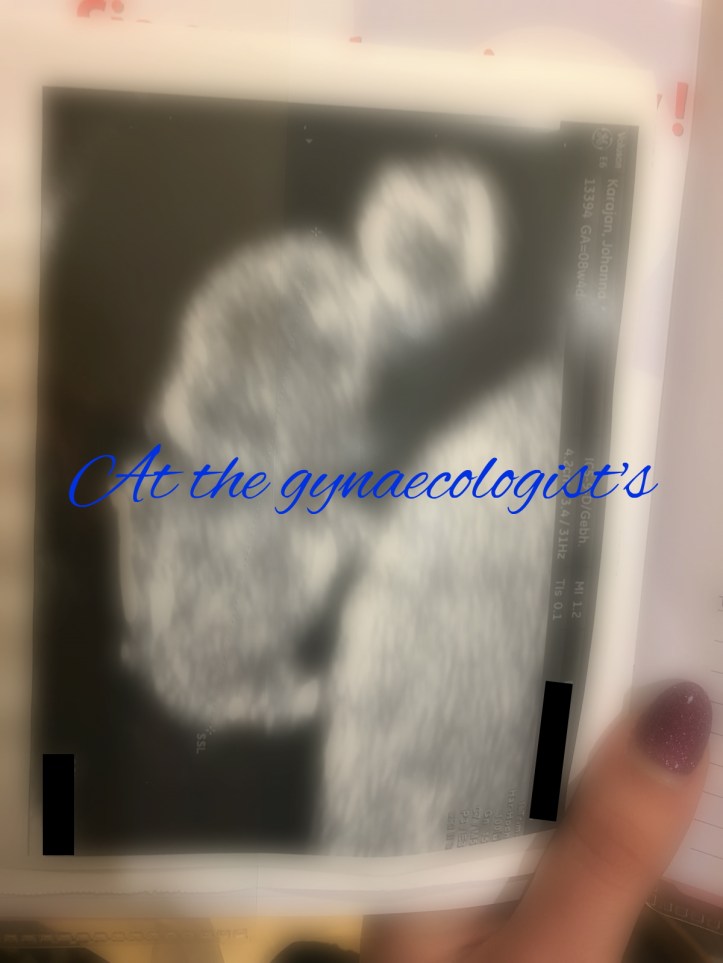An ultrasound image