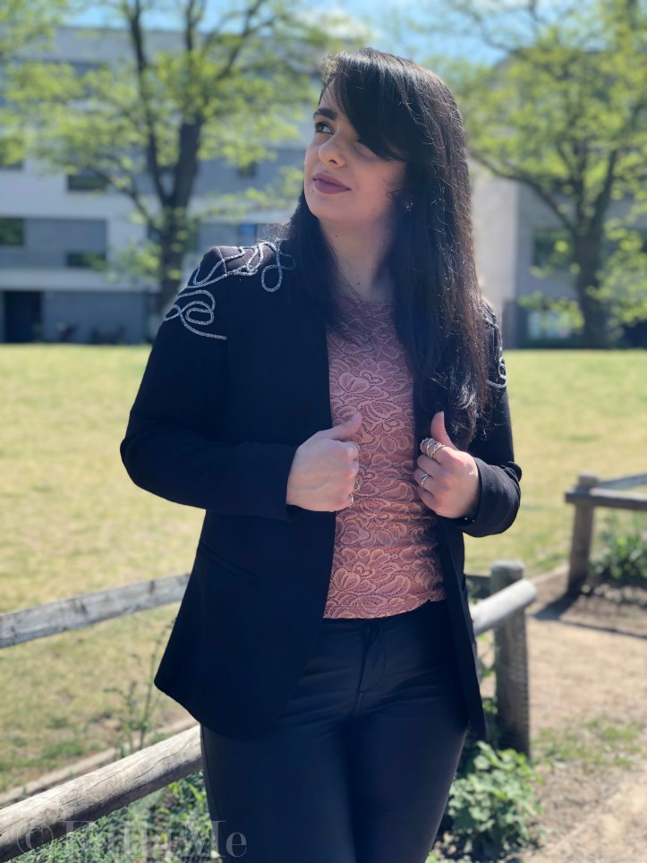 The celebration-look for casualty: lace and glitter