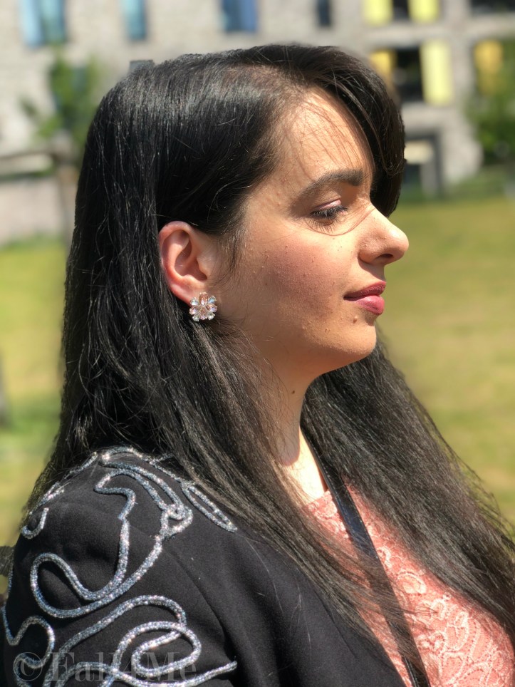 The celebration-look for casualty: lace and glitter