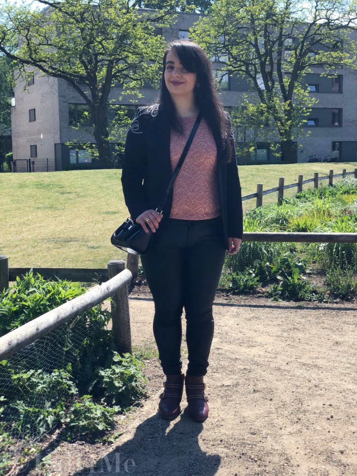 The celebration-look for casualty: lace and glitter